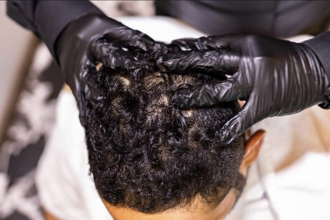 Scalp treatment at Antibes